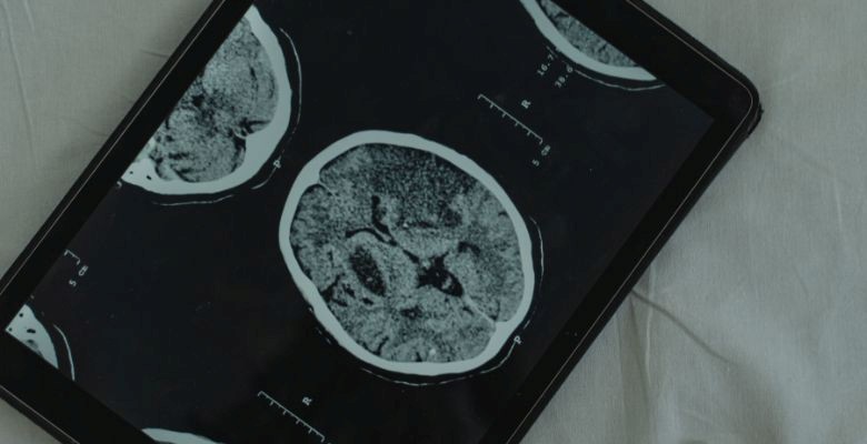 Centro para tratamento de doenças do cérebro com tecnologia digital inaugurado em Portugal